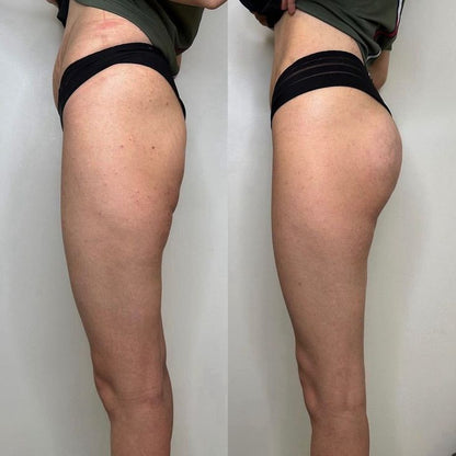 BumBum Cream – Firming & Lifting Body Cream for Cellulite and Stretch Marks
