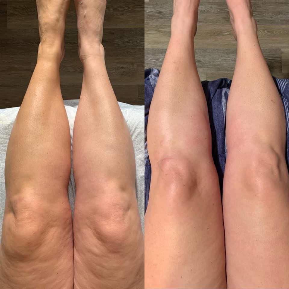 BumBum Cream – Firming & Lifting Body Cream for Cellulite and Stretch Marks