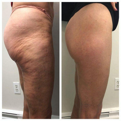 BumBum Cream – Firming & Lifting Body Cream for Cellulite and Stretch Marks